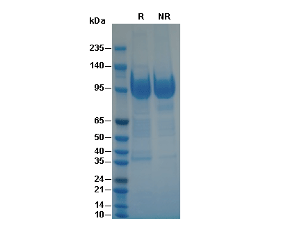 Recombinant Human ACE-2 Protein, CF (HEK293)验证数据
