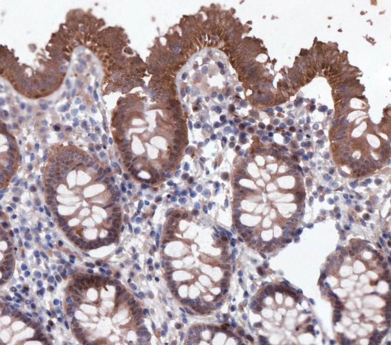 F3674-IHC1.png