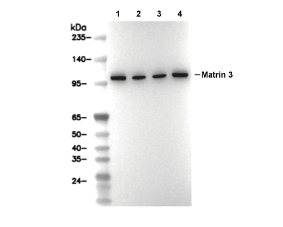 F5989-wb.gif