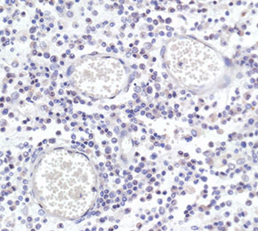 F8242-IHC1.jpg