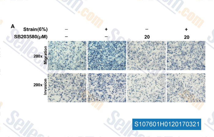 SB203580 p38 MAPK 抑制剂 现货供应 美国品牌 免费采购电话4006686834